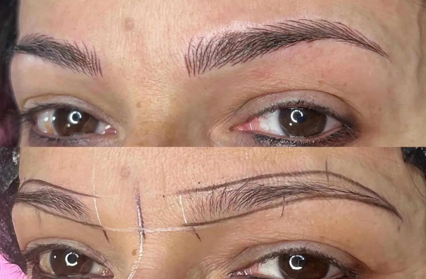 Riyaanz Aesthetic Laser Tattoo Removal Facebook ad