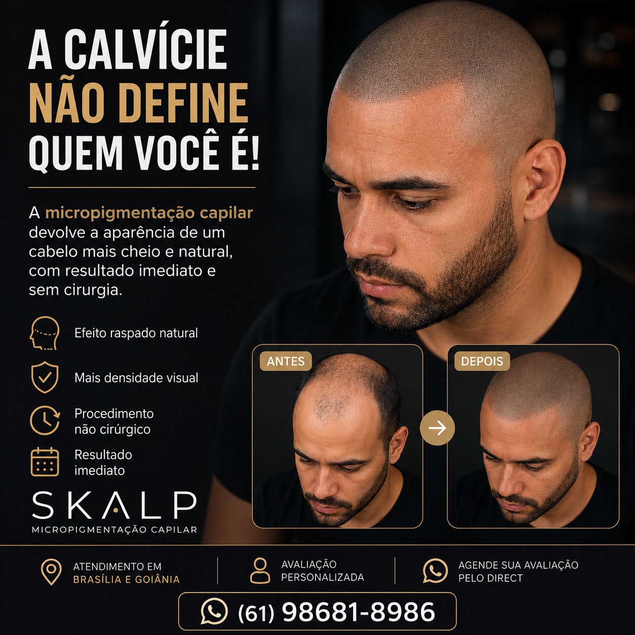 Skalp Micropigmentação DF Facebook ad: A CALVÍCIE TE INCOMODA?