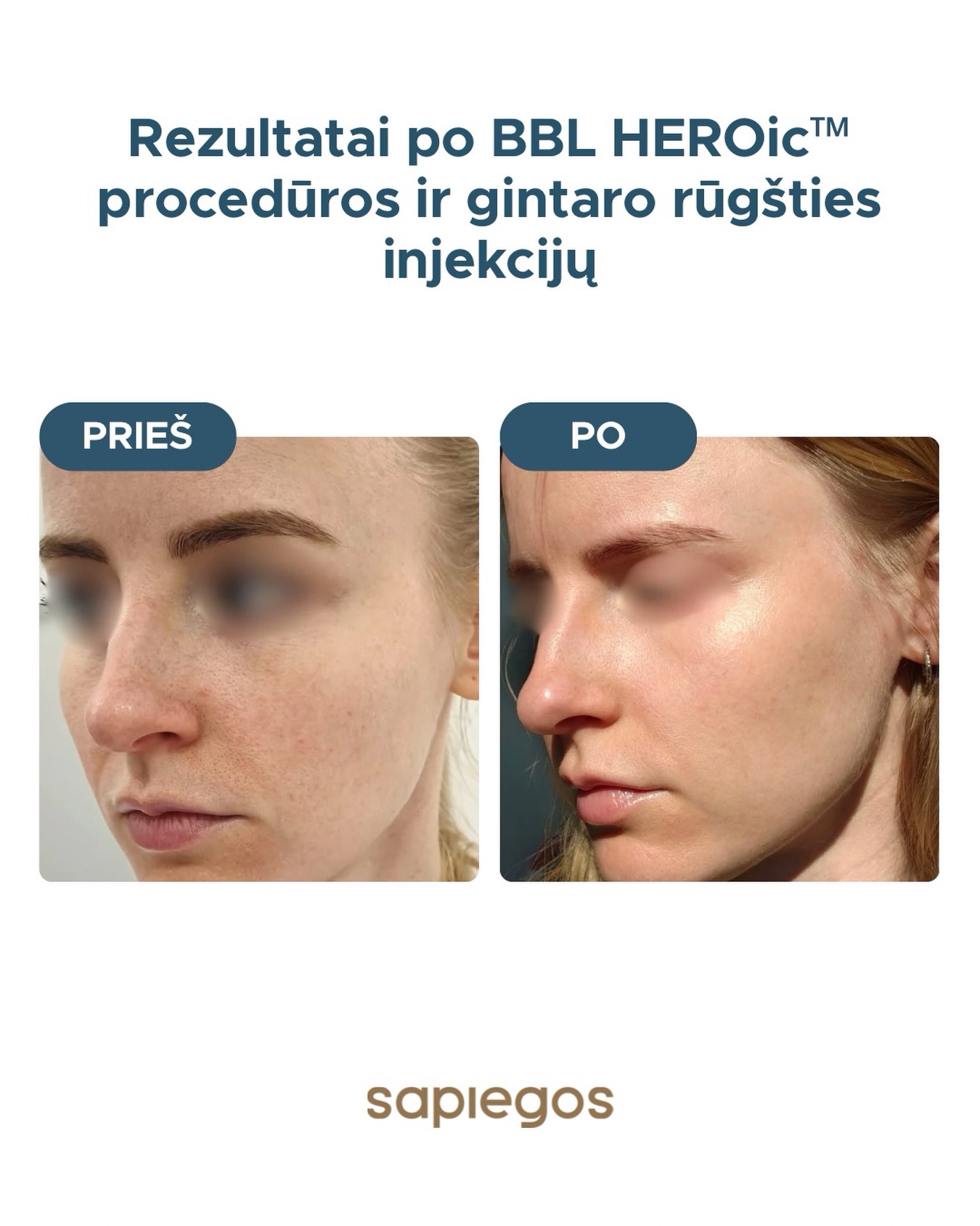 Sapiegos Klinika - Lazerinės Dermatologijos Klinika Facebook ad