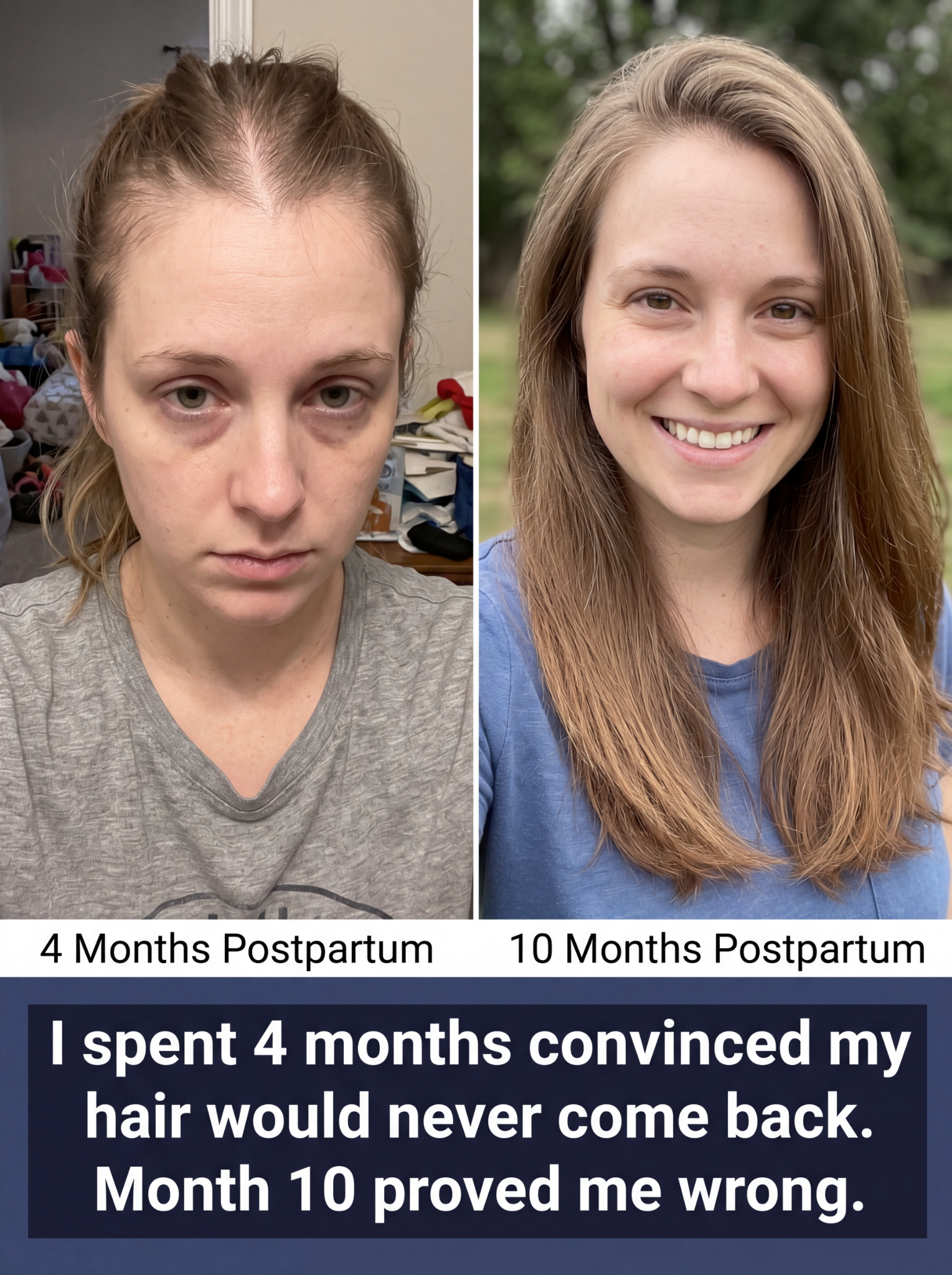 Soothbliss. Facebook ad: For Postpartum Hair Loss.
