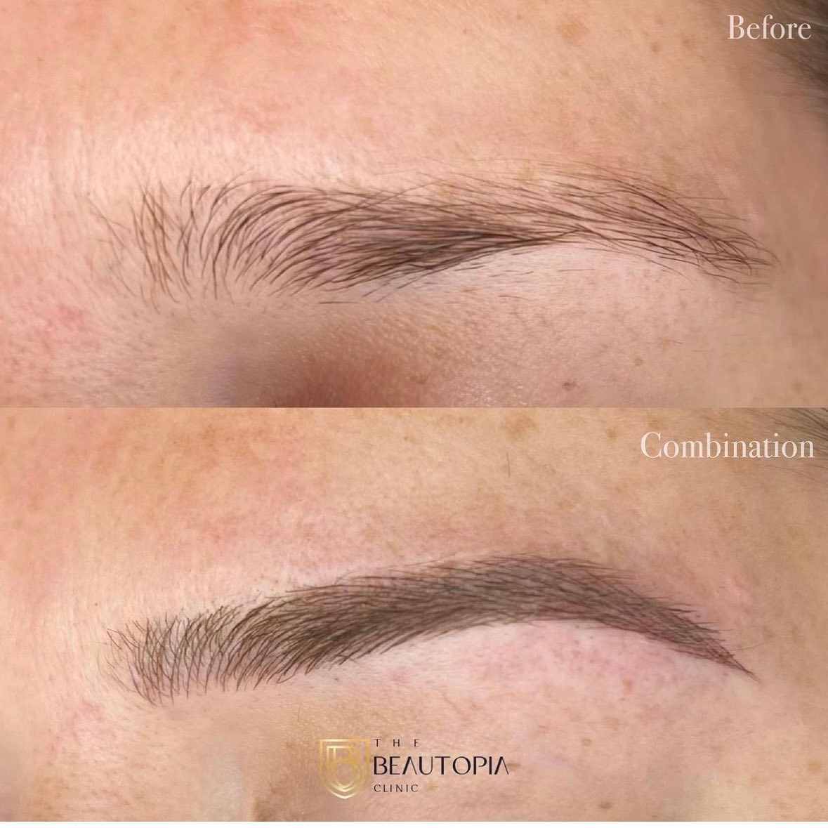 The Beautopia Clinic Facebook ad