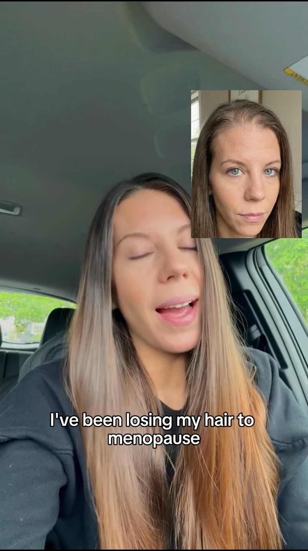 Bloom & Bond Facebook ad: Help Hair Loss Naturally
