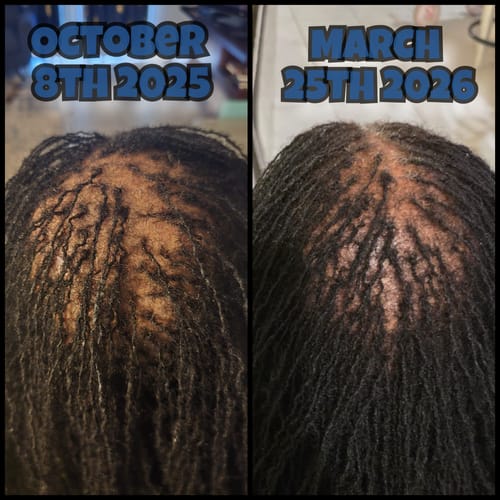 Black Hair Growth Remedy Facebook ad