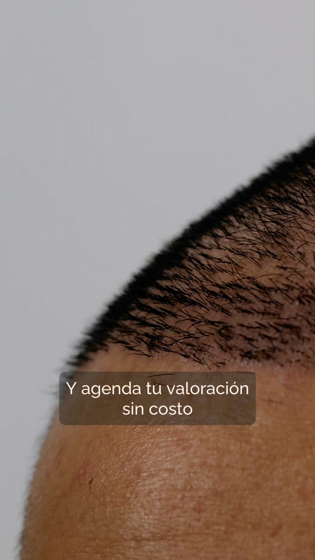 Dr Edgar Pulido - Medicina Estetica Facebook ad: Agenda tu cita GRATIS
