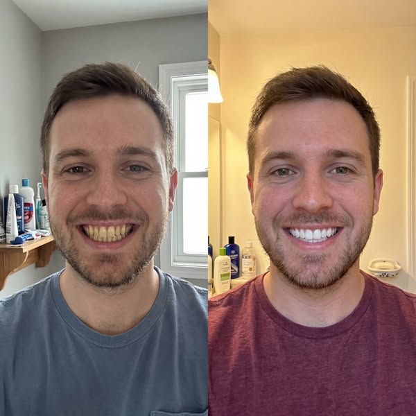 Glowchews Facebook ad: The 2-Minute Whitening Trick That Works