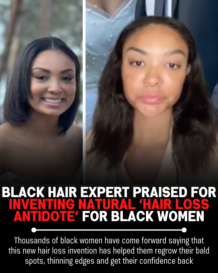 Black Hair Growth Remedy Facebook ad