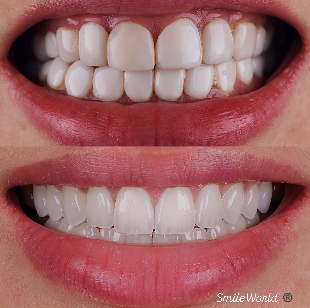 osdental.usa Facebook ad