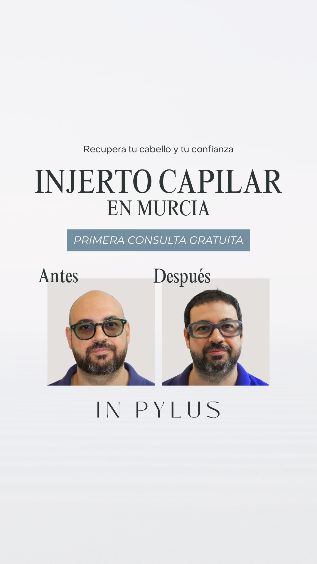 IN PYLUS - Clínica de Trasplante Capilar Facebook ad