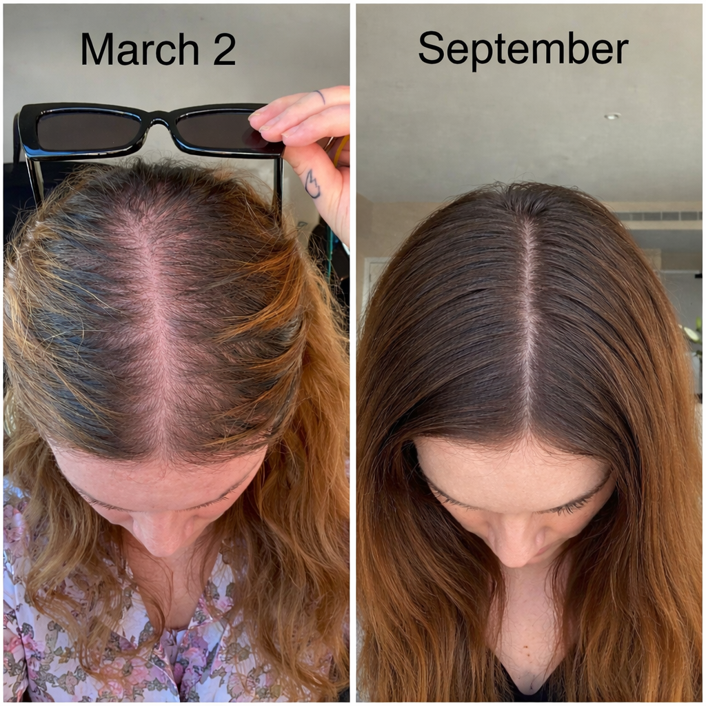 Ashwilliamms Facebook ad: Read this if you have GLP-1 hair loss