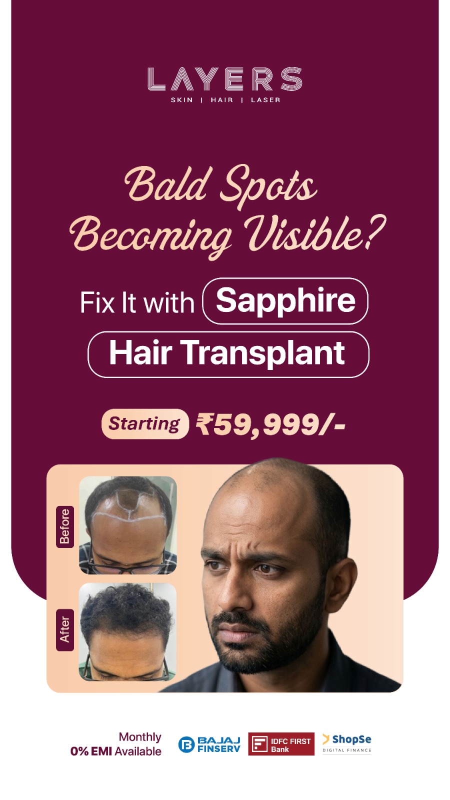 Layers Clinics - Skin & Hair Facebook ad