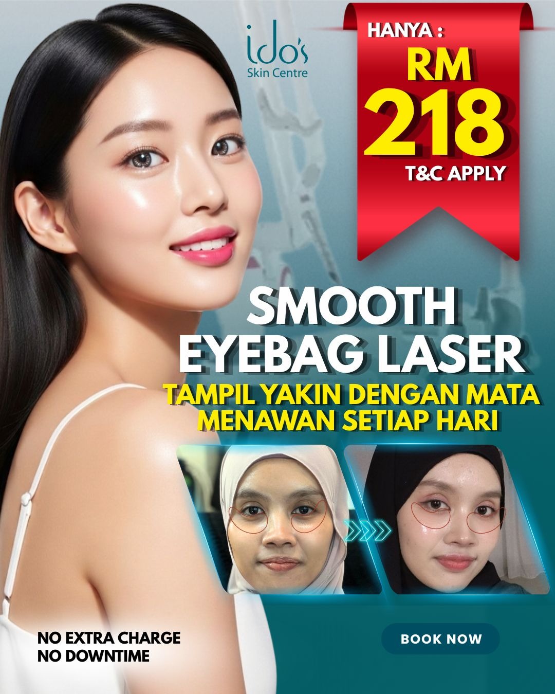 Idos Skin Centre Facebook ad: PROMO KL HANYA RM218