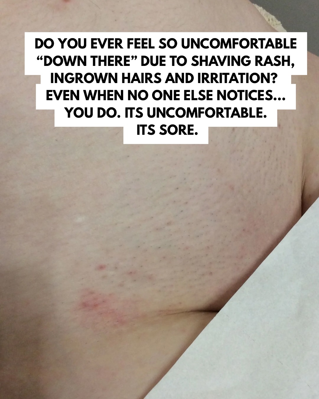 That Laser Place Facebook ad: Do you ever feel so uncomfortable down there…
