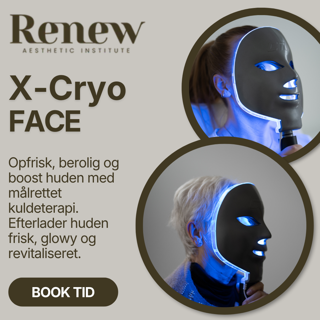 ReNew Silkeborg Facebook ad: Book tid til behandling