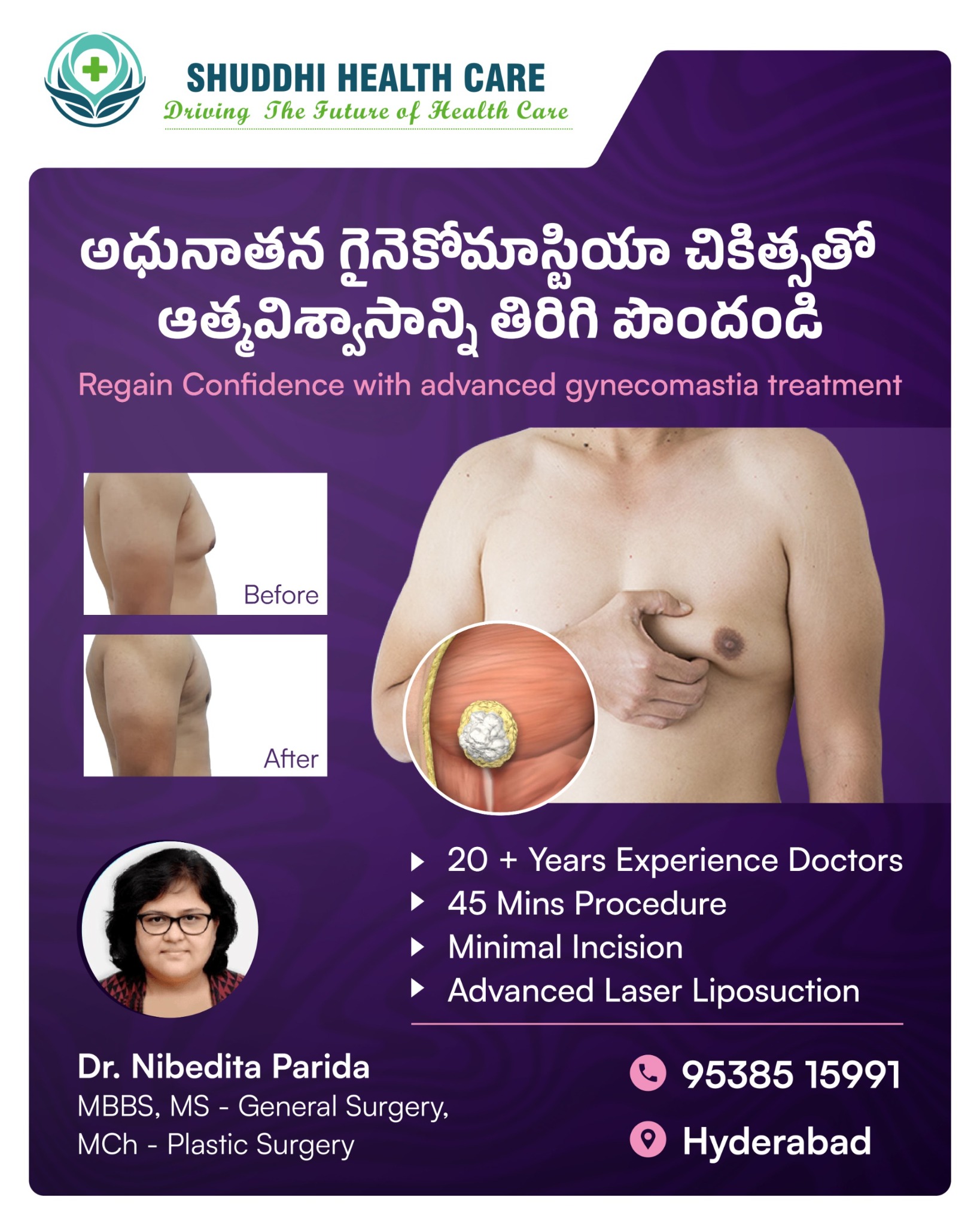 Shuddhi Healthcare Facebook ad: Advanced Gynecomastia Treatment