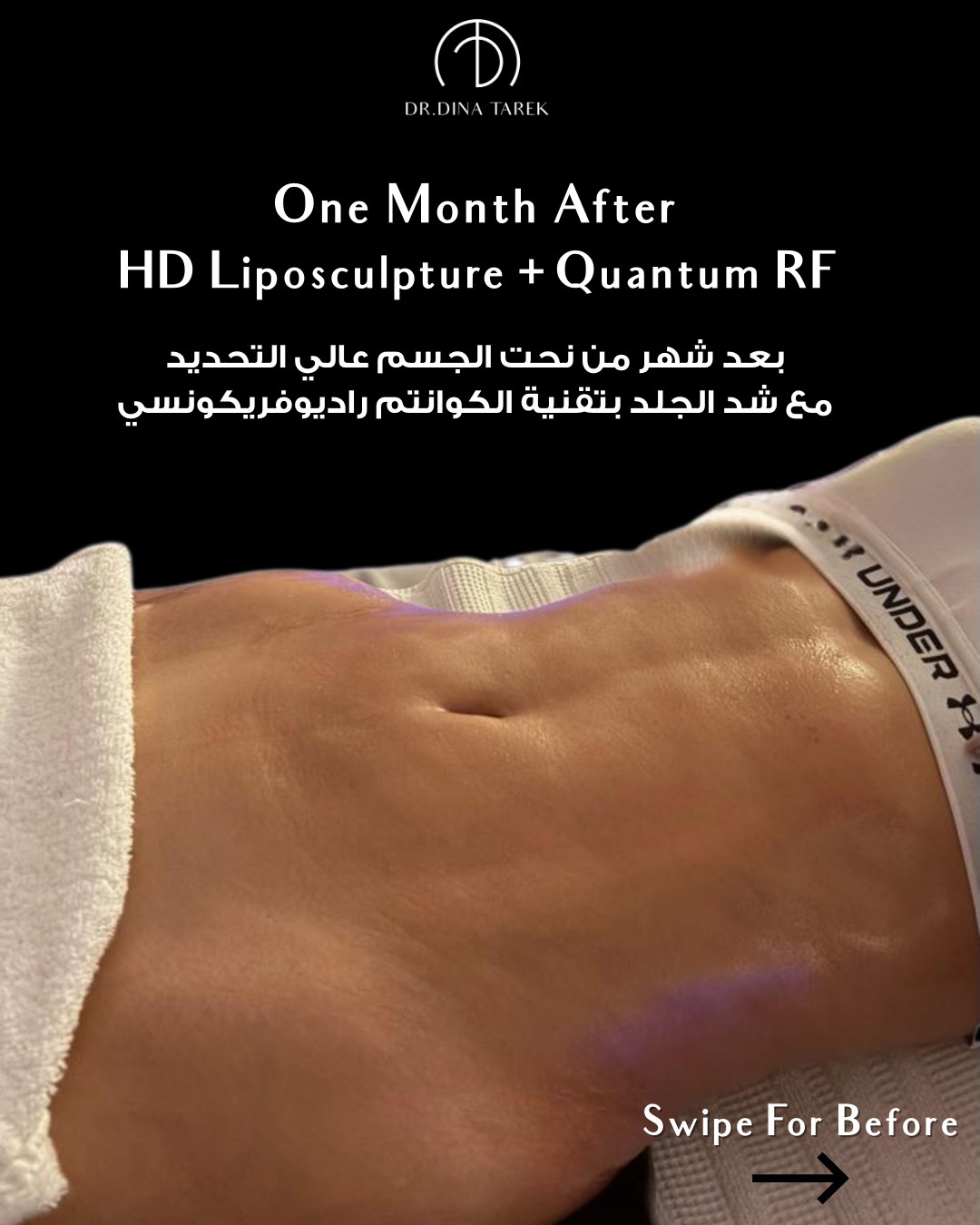 Dr. Dina Tarek Facebook ad: One month can make a real difference.