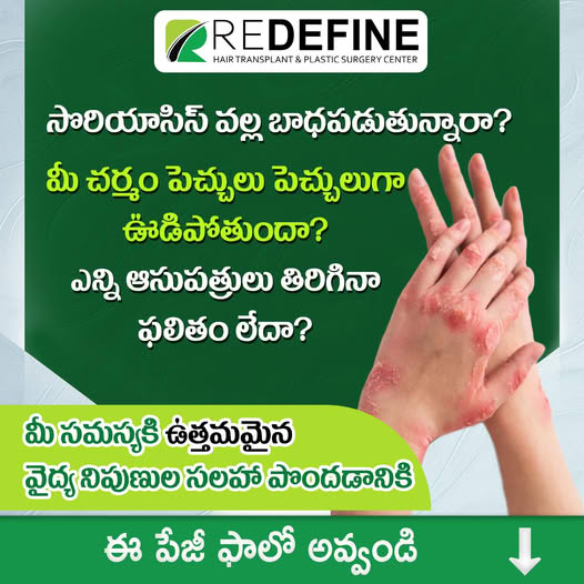 Redefine Skin and Hair Transplant Center Facebook ad