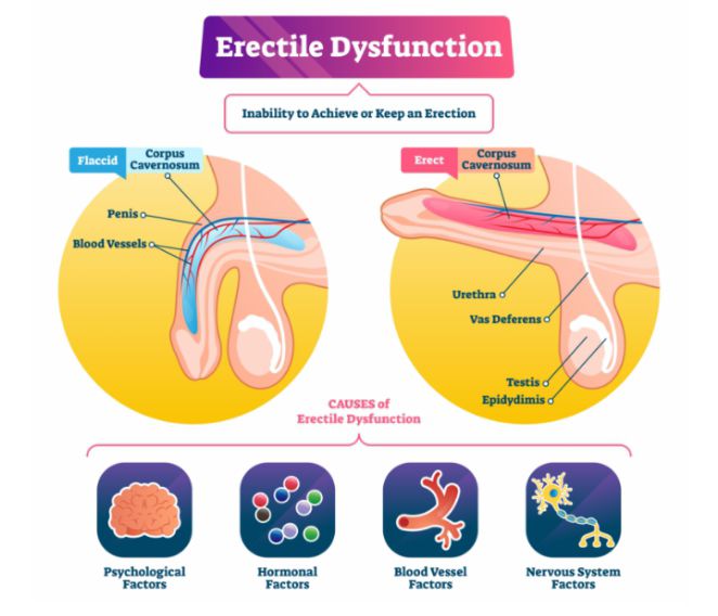 Medicare Health and wellness center Facebook ad: Erectile Dysfunction