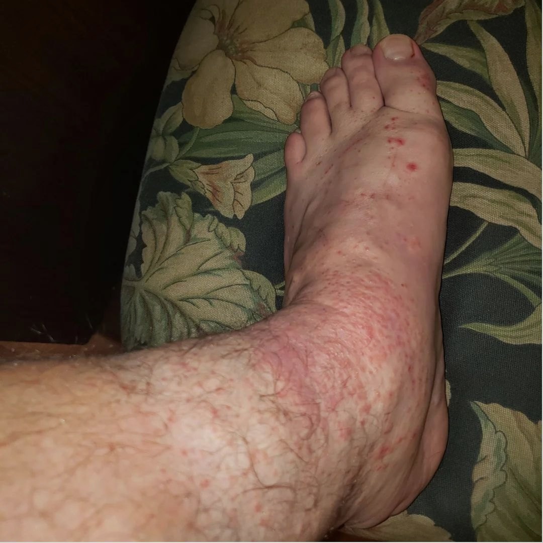 David Bennett Facebook ad: He died in a wheelchair with both legs amputated…