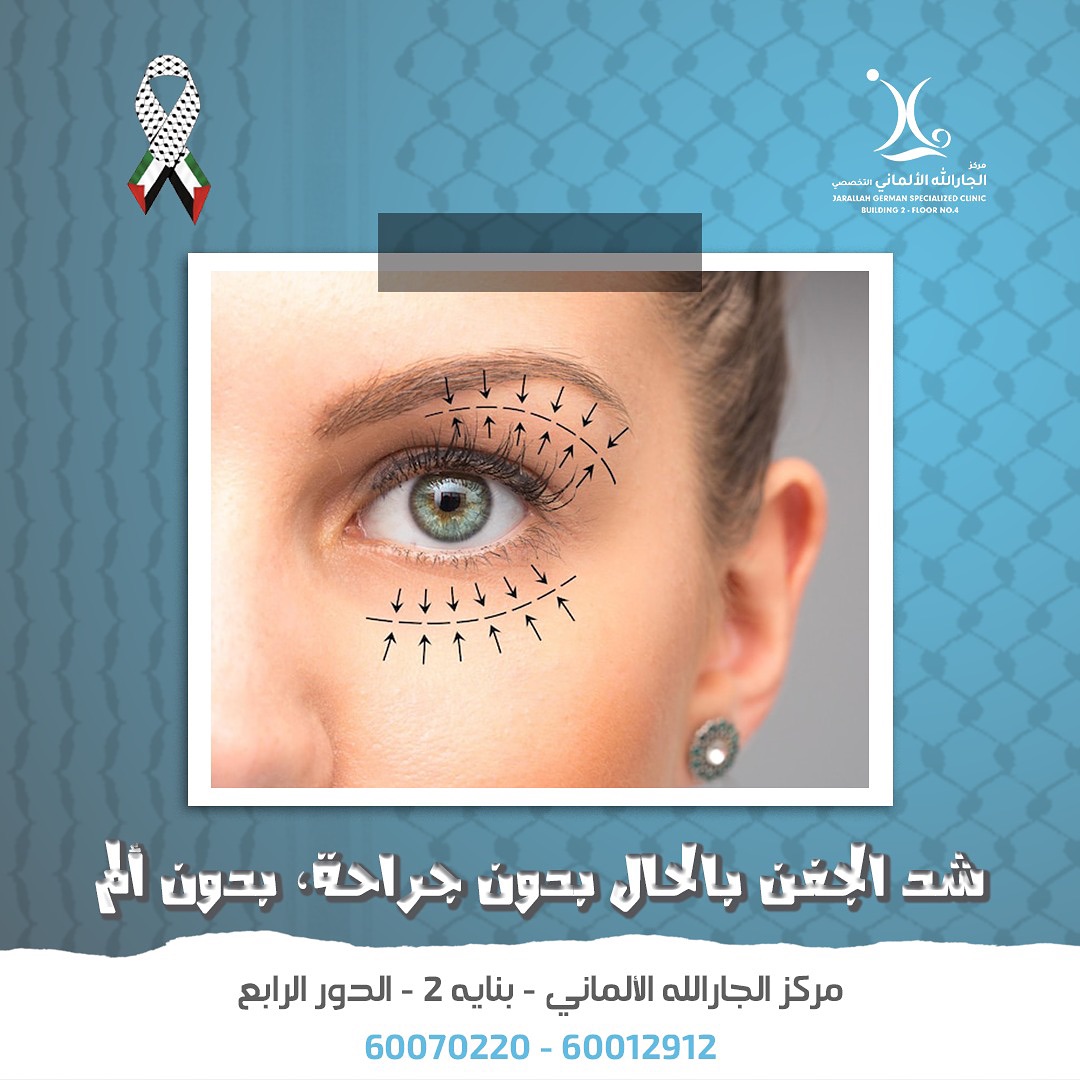Jarallah Derma Facebook ad: د محسن شاهين خبرة ٤٥ عام