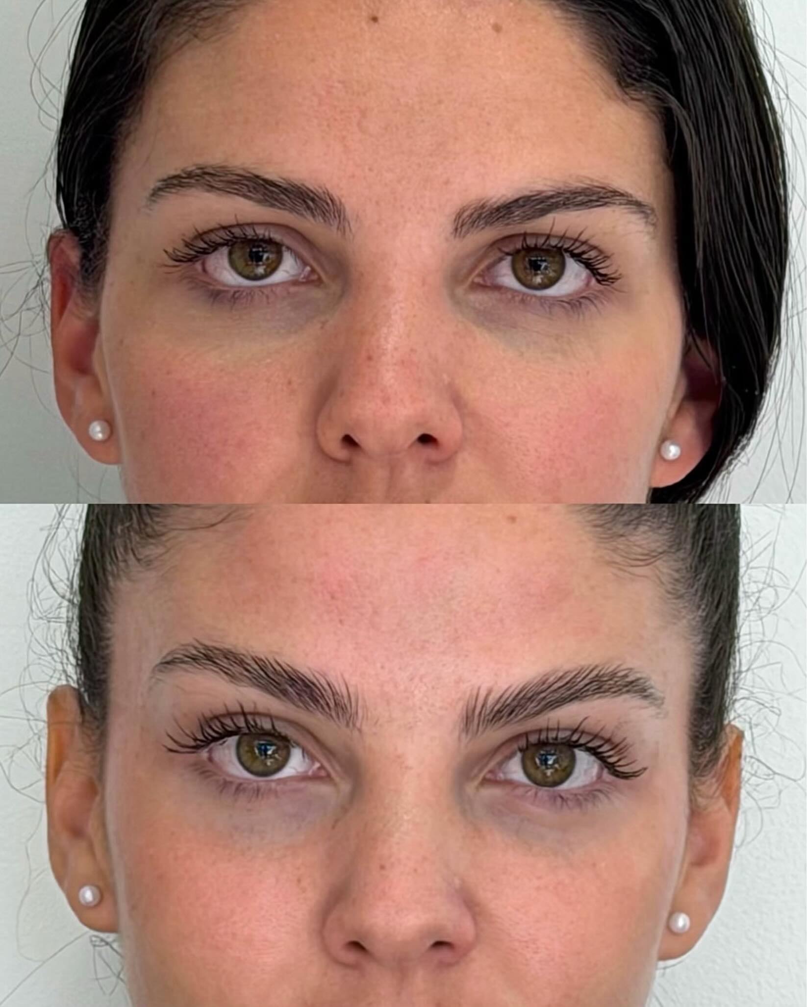 glosclinic Facebook ad: Tired eyes, heavy brows, or that I look…