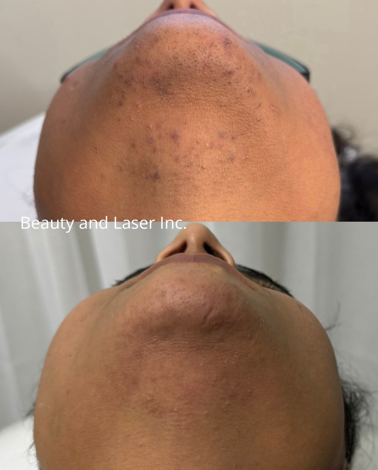 Beauty and Laser Inc. Facebook ad