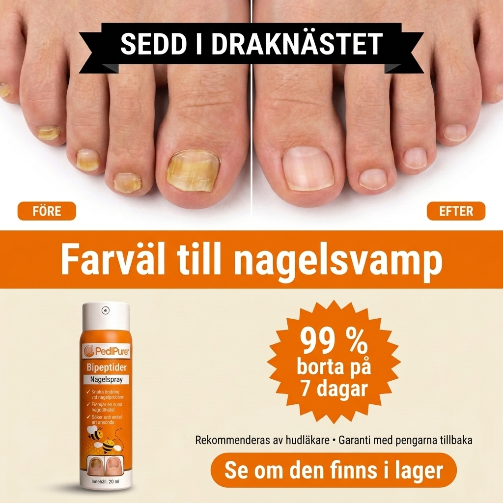 Medicinska Blicken Facebook ad: Svampens skyddsbarriär som dina krämer inte når