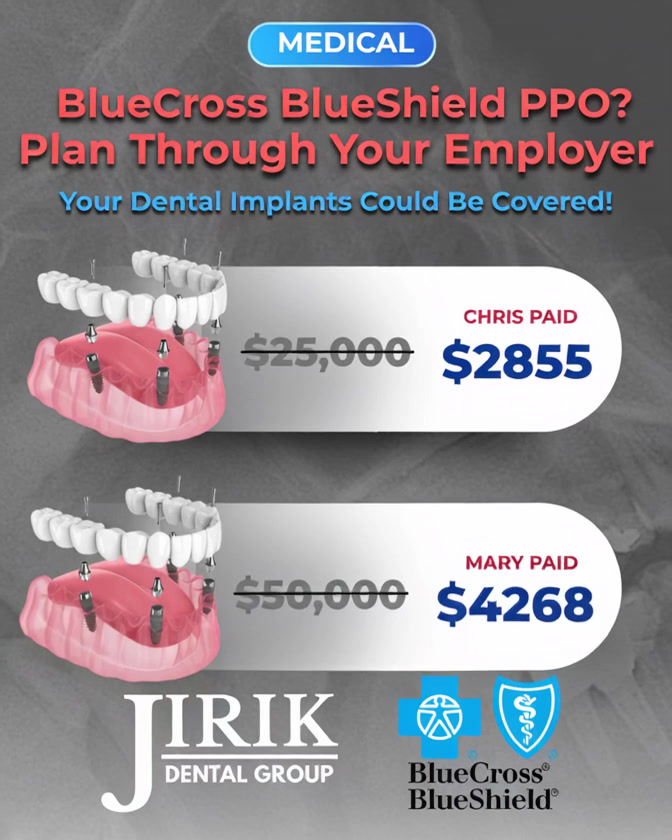 Jirik Dental Group Facebook ad: Free consultation & coverage check - Book now!