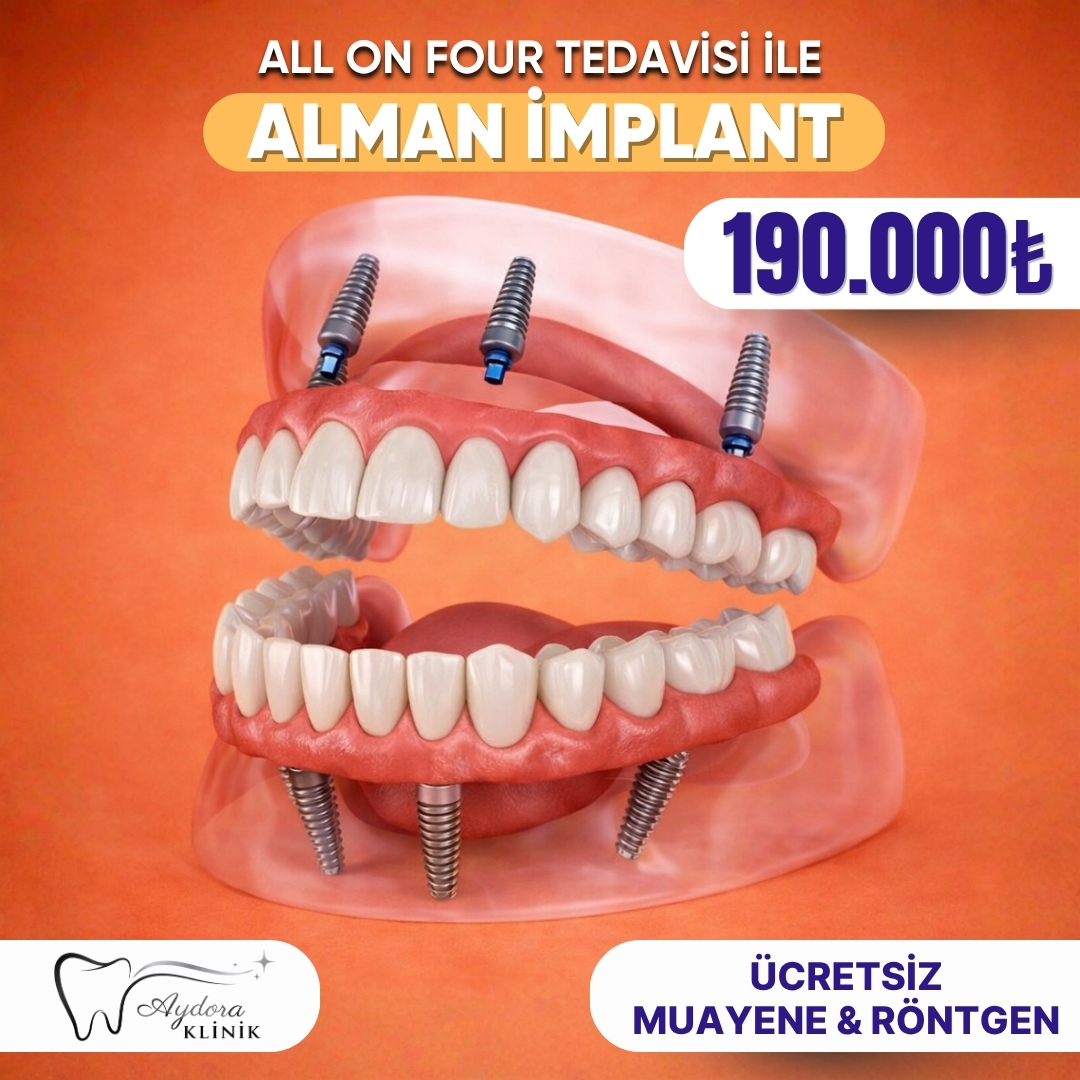 Aydora Clinic Facebook ad: All On Four İmplant Tedavisi ile Sabit ve Estetik Dişler