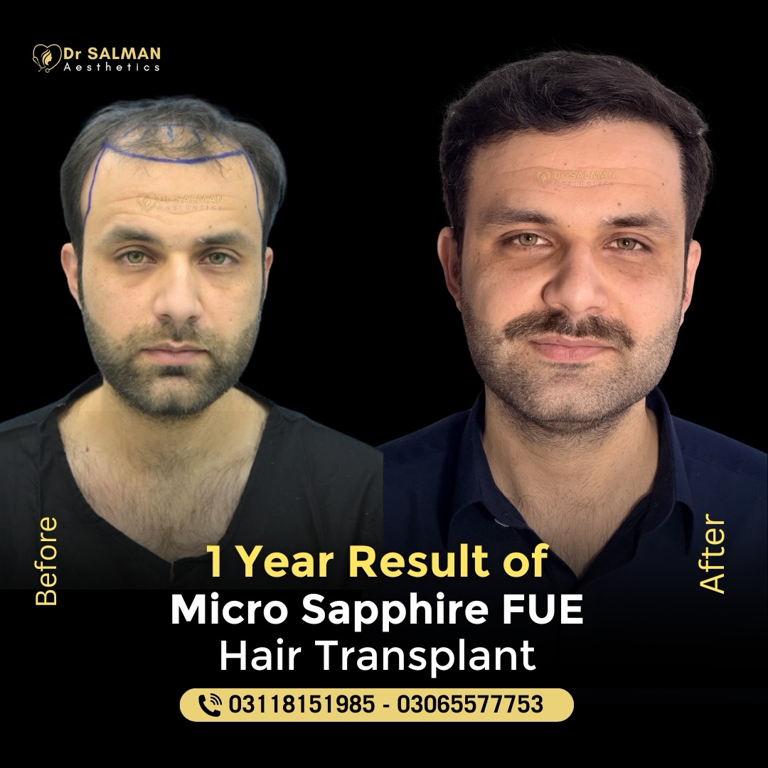 Cosmetic Expert Clinic Facebook ad: Transformation of not just Hair but of Personality…