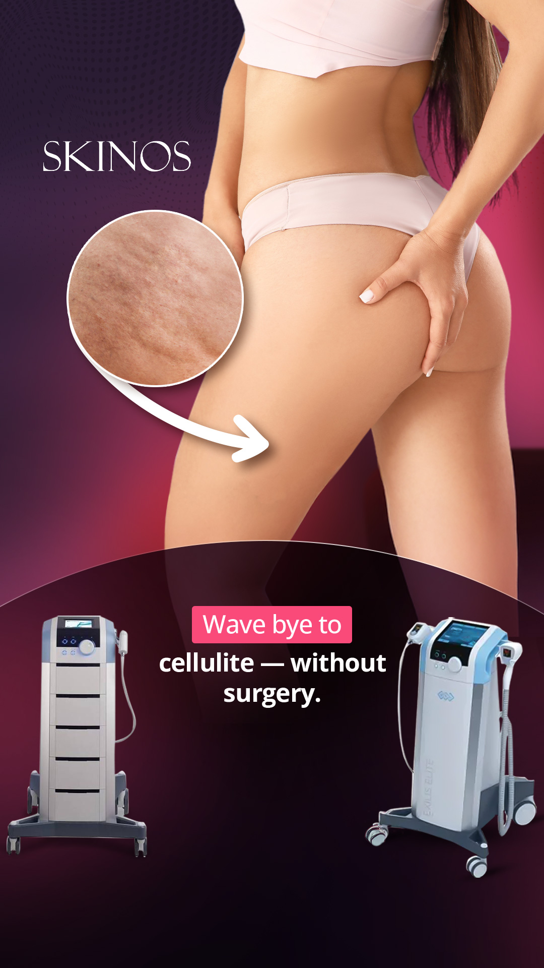SKINOS Facebook ad