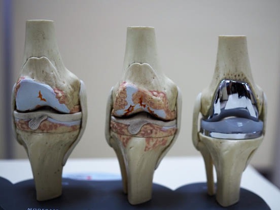 St. Louis Pain Center, LLC Facebook ad: Breakthrough Treatment for Knee Pain Relief