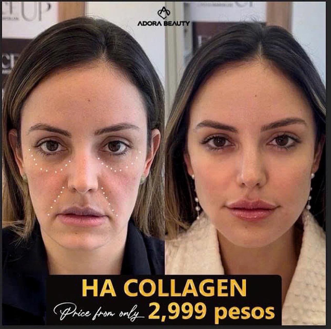 Adora Beauty Clinic in Manila Facebook ad