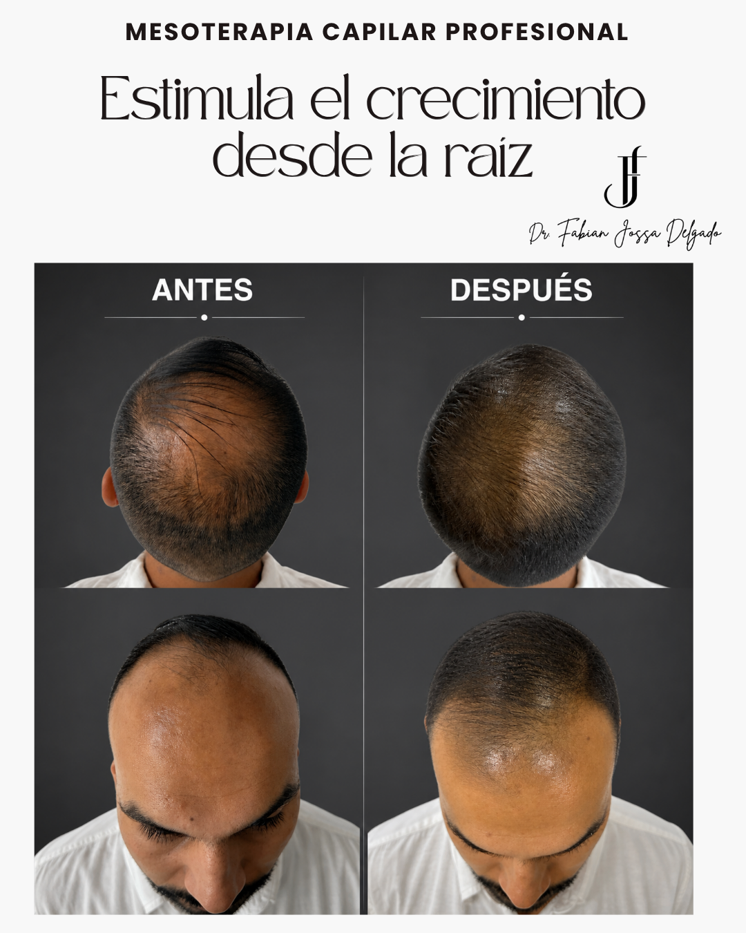 Dr. Fabian Jossa Facebook ad: Recupera tu cabello a tiempo