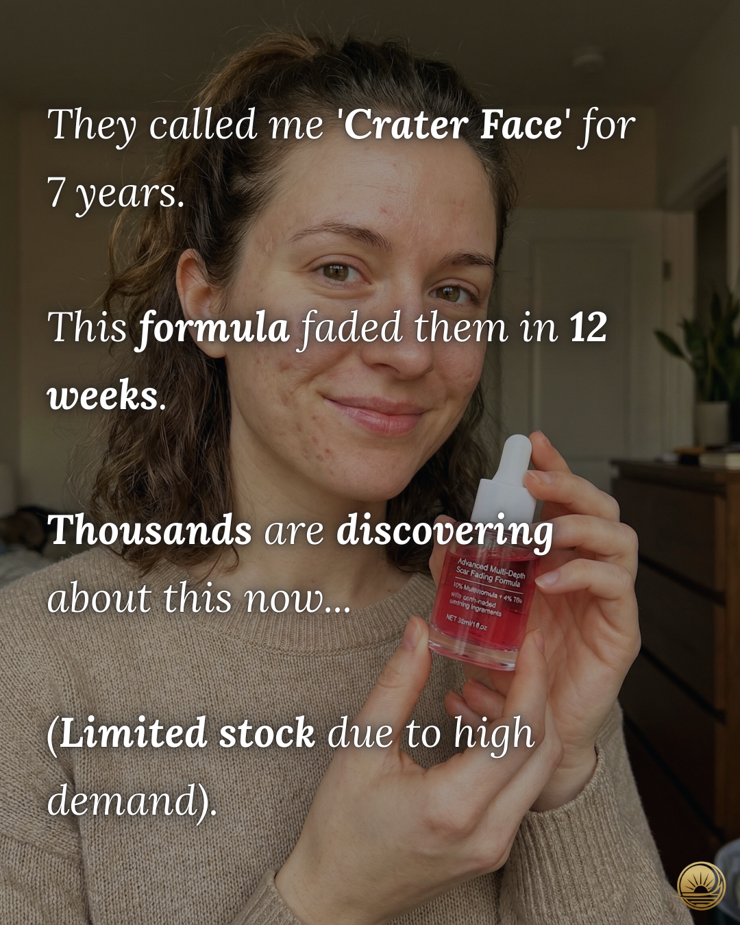 Terraura Facebook ad: From Crater to Confident in 12 Weeks