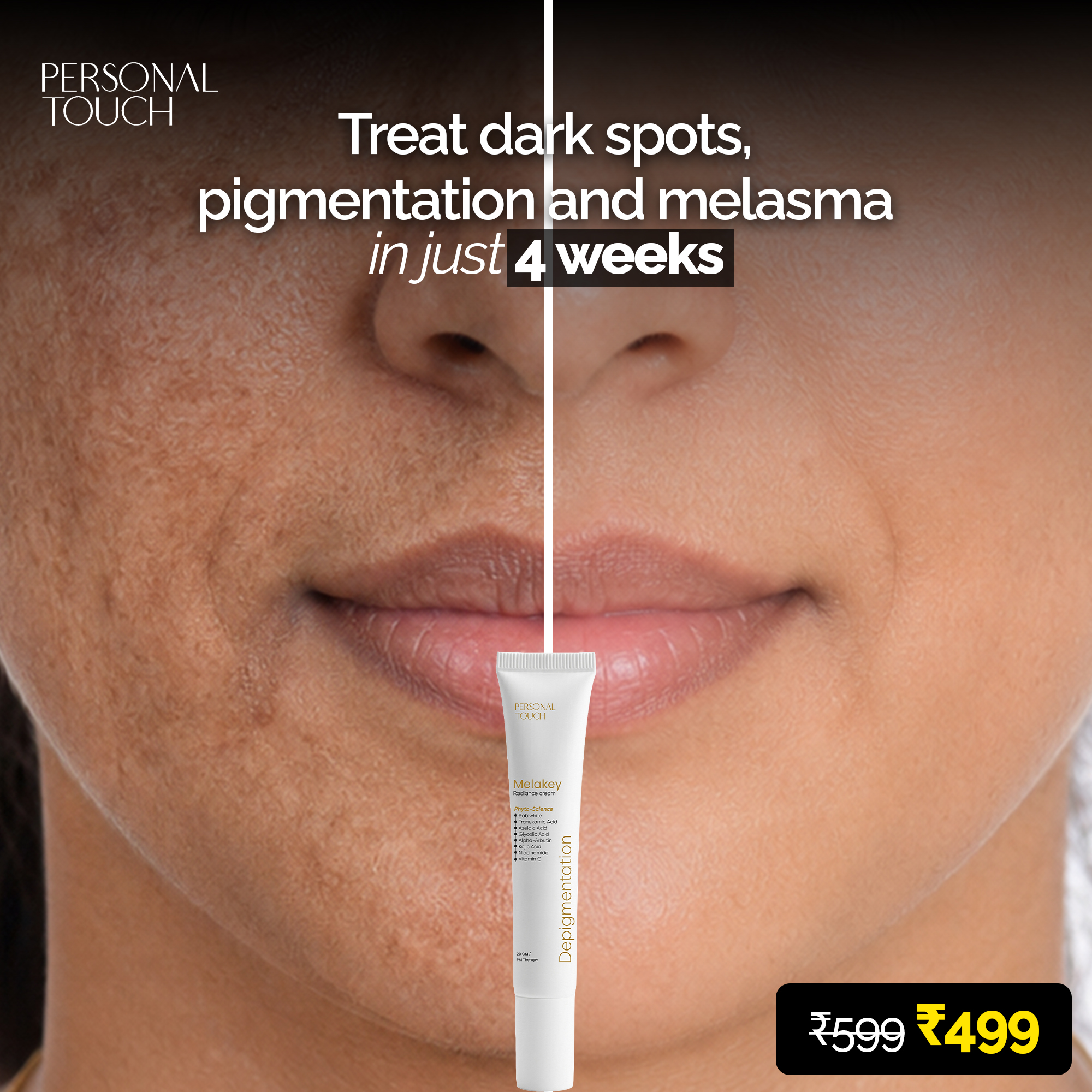Skin Care Personal Touch Facebook ad: Melasma? Dark Spots? This Works.