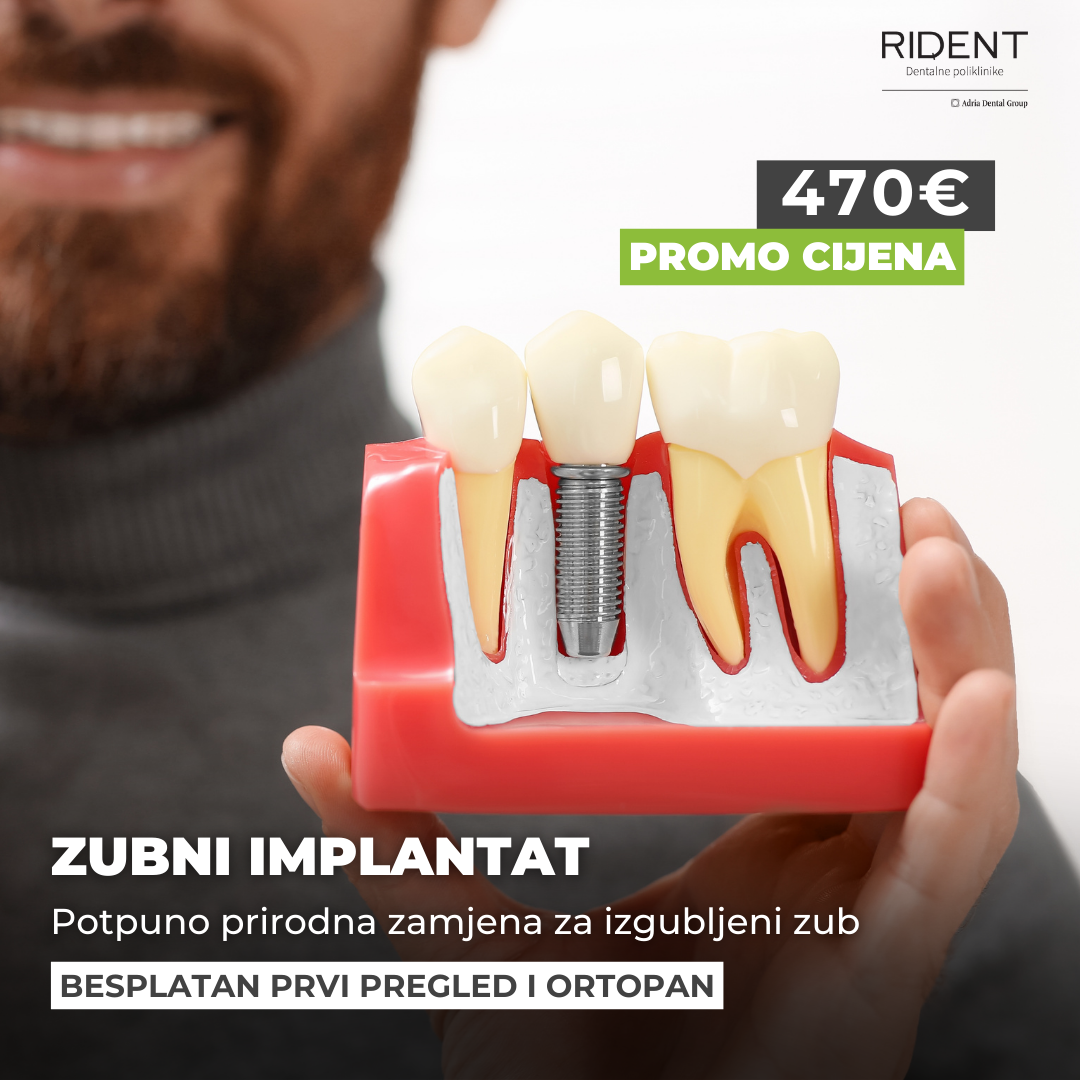 Rident Hrvatska Facebook ad