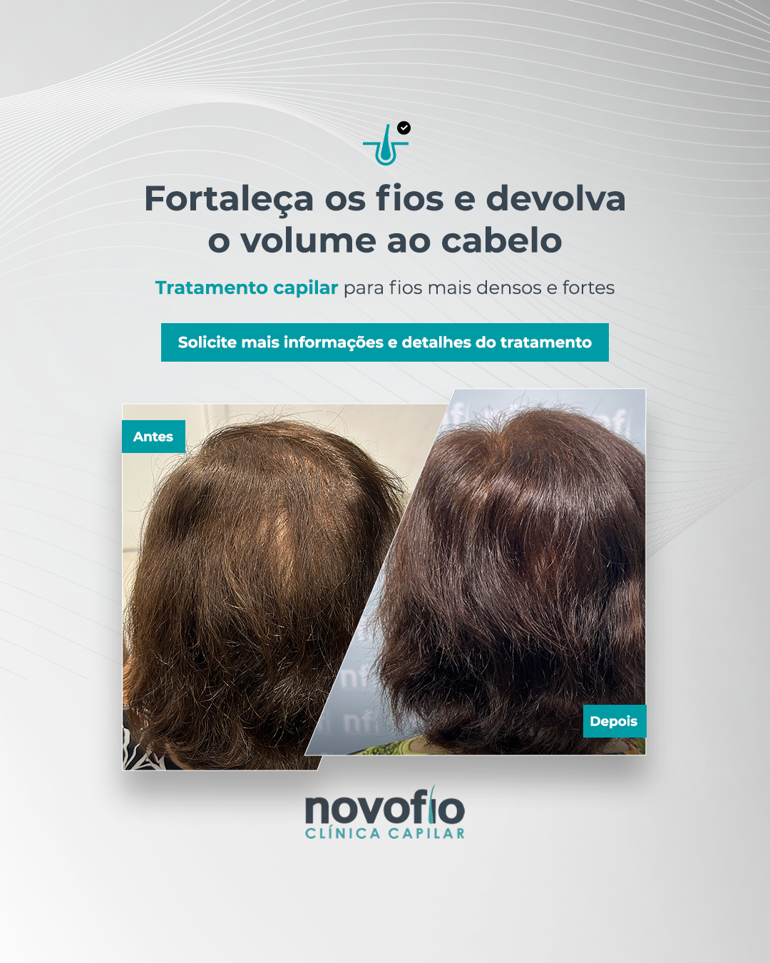 Novofio Osasco Clínica Capilar Facebook ad