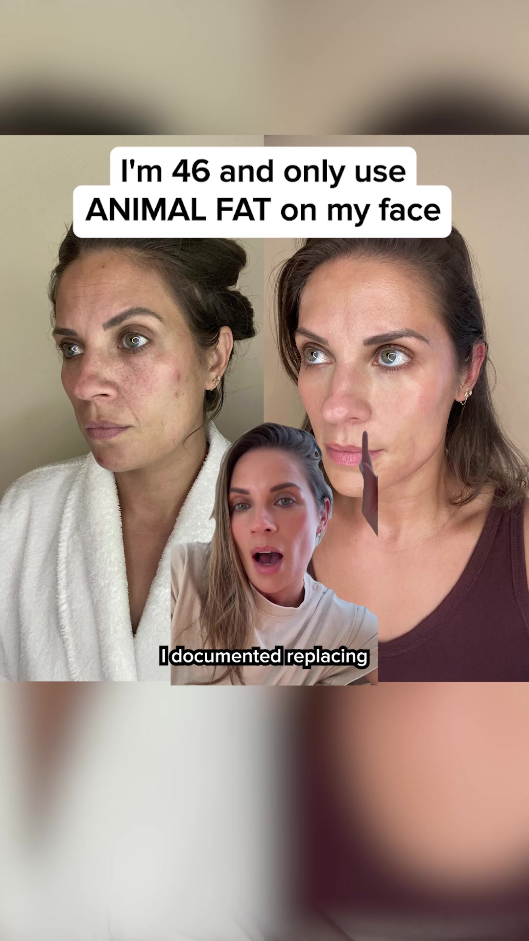 Based Supplies Facebook ad: Restore Your Skin in 3 Weeks!
