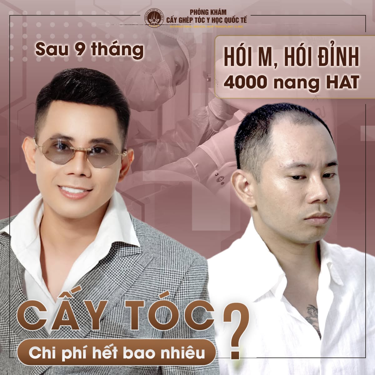 Cấy tóc Y học Quốc tế HN Hair Transplant Facebook ad
