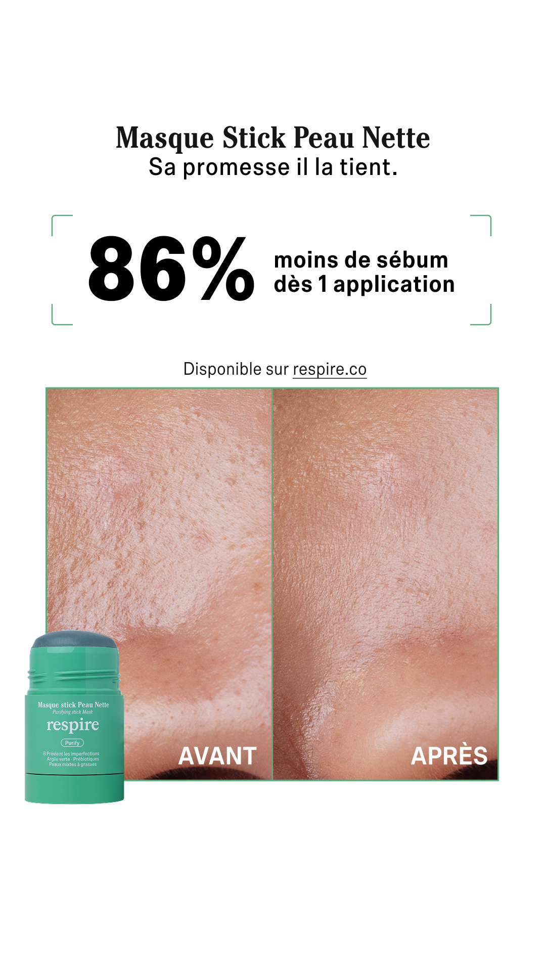 Respire Facebook ad