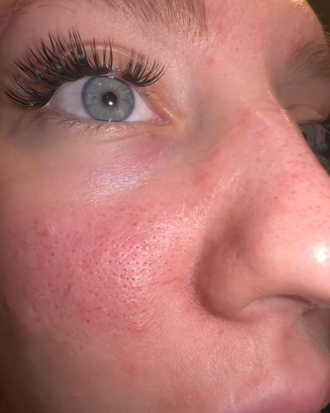 Cleanskin Store Facebook ad: Känn dig bekväm med din hud igen