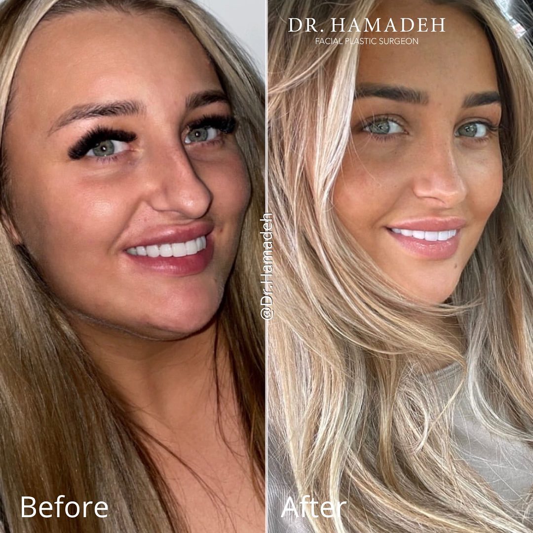 Dr Nizar Hamadeh Facebook ad: ๐๐ผ๐บ๐ถ๐ป๐ด ๐๐ฝ ๐๐ผ ๐ผ๐ป๐ฒ ๐๐ฒ๐ฎ๐ฟ ๐ฝ๐ผ๐๐ ๐ผ๐ฝ๐ฝโฆ