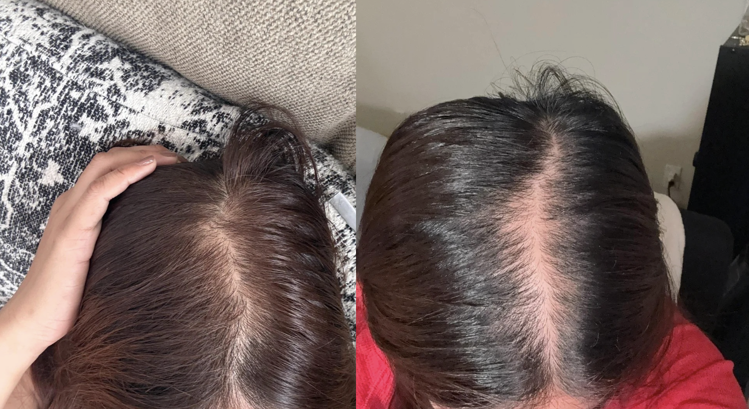 Thyroid Hair Secrets Facebook ad: Read this if the medication that's supposed to help is…
