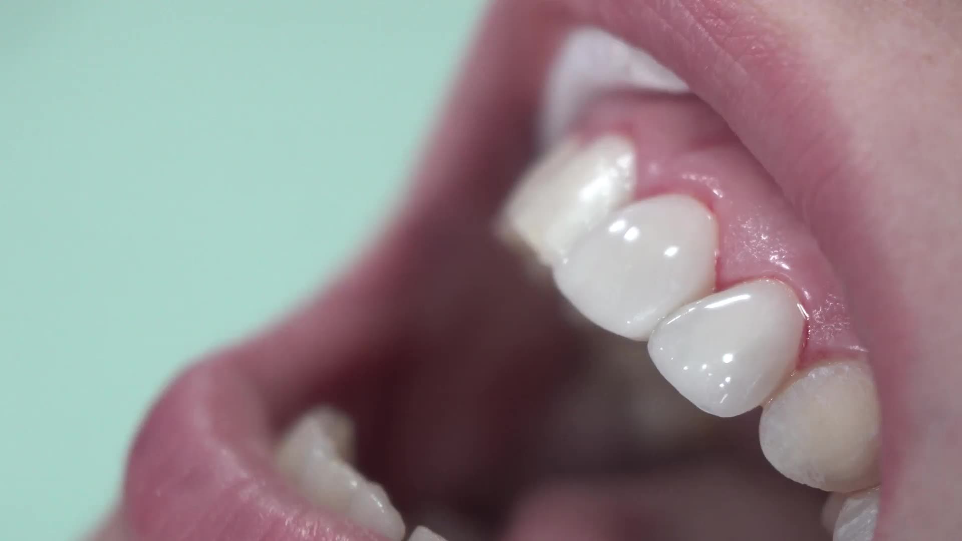 Dentatur Dental Health Clinics Facebook ad: Dental Centre in Turkey
