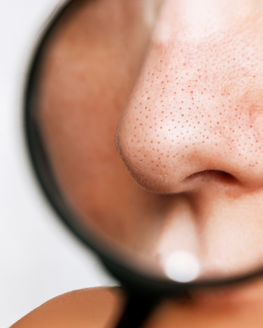 Skinmed AG Facebook ad: Skinmed | Klinik für Dermatologie & plastische Chirurgie