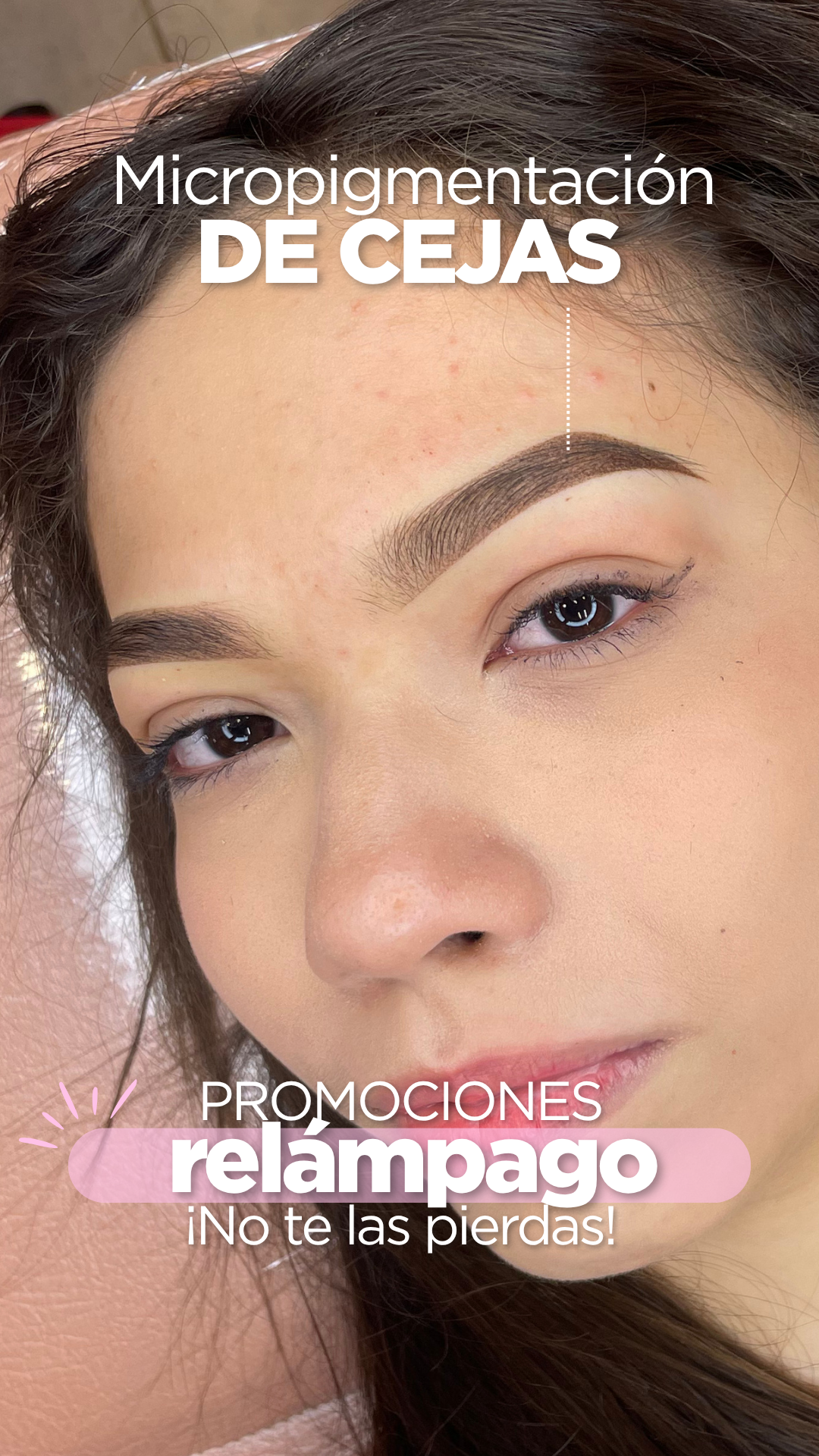 Glamurosas Estética Facial Cali Facebook ad from Jun 22, 2026