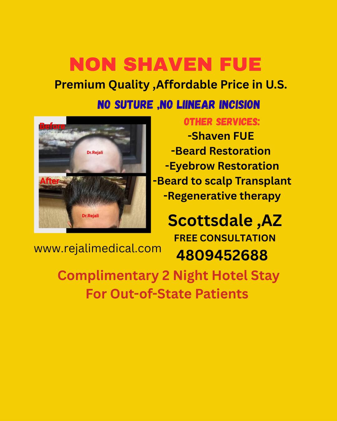 Rejalihairrestoration Facebook ad: Hair Transplant in Scottsdale, AZ | Dr. Rejali Hair & Skin…