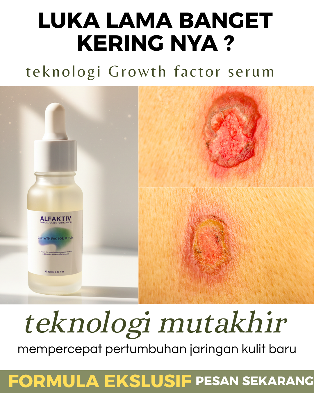 Alfaktiv.id Facebook ad