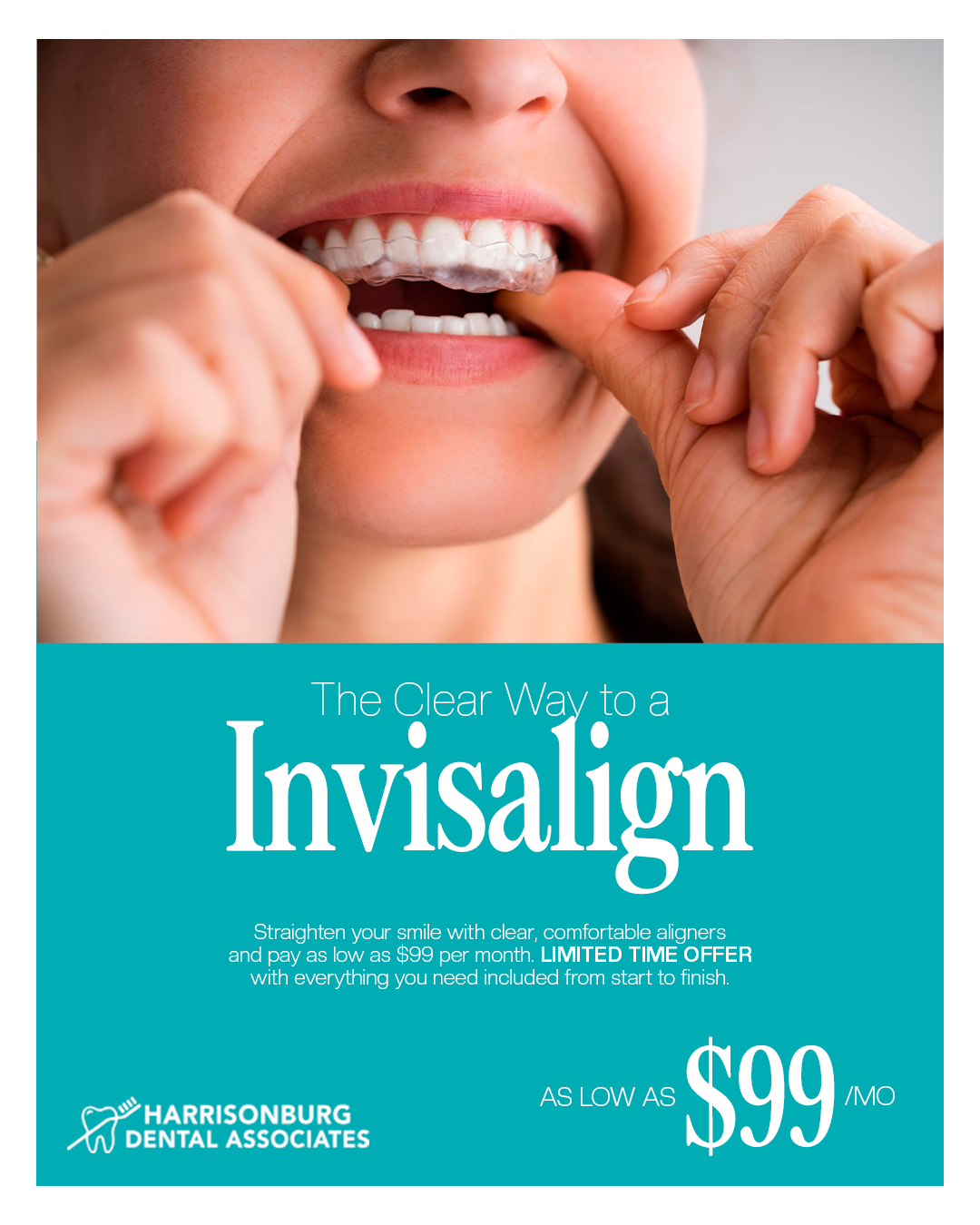Harrisonburg Dental Associates Facebook ad: Harrisonburg! Invisalign Special is Here!
