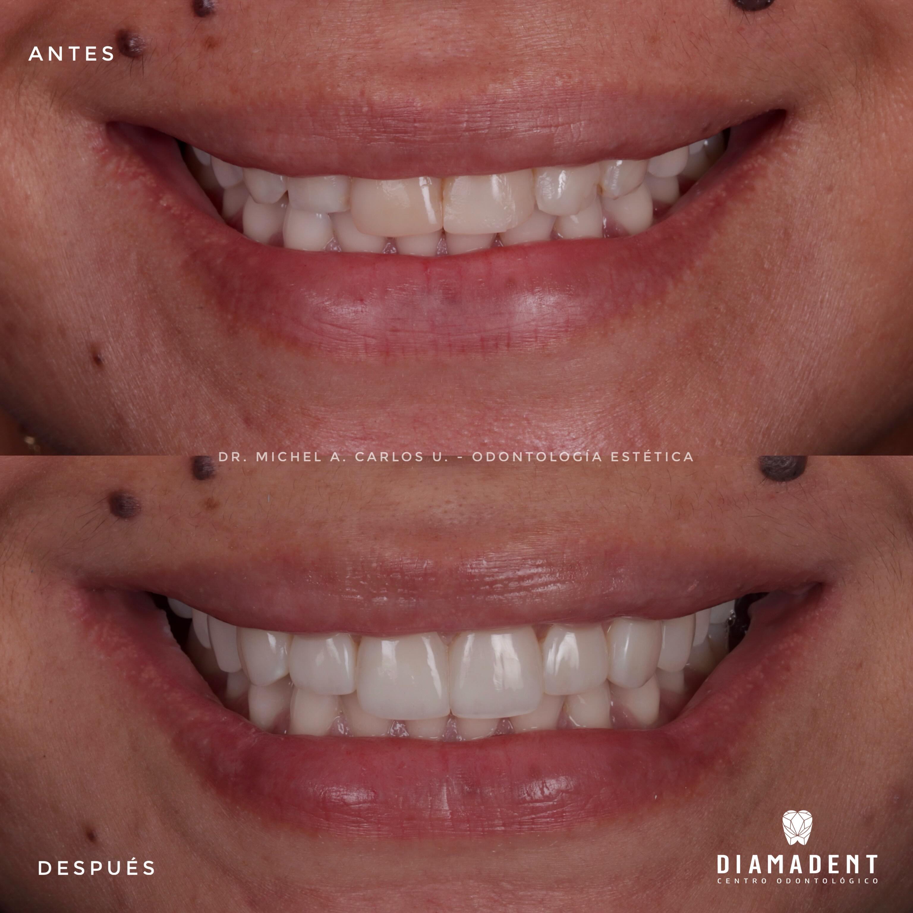 Diamadent Centro Odontológico Facebook ad: Transformamos sonrisas, conservando lo más importante: tus…